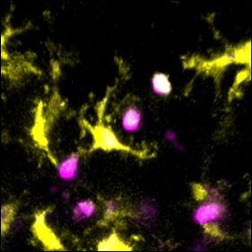 Nuova tecnica di imaging per studiare le cellule T