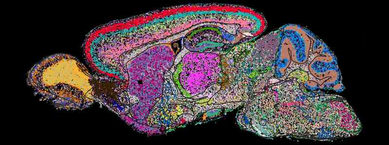 Demistificare il cervello di un mammifero, cellula per cellula