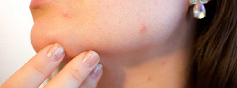 Processi molecolari dei tumori della pelle