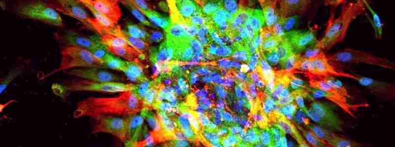 Cicatrici d'organo da cellule staminali