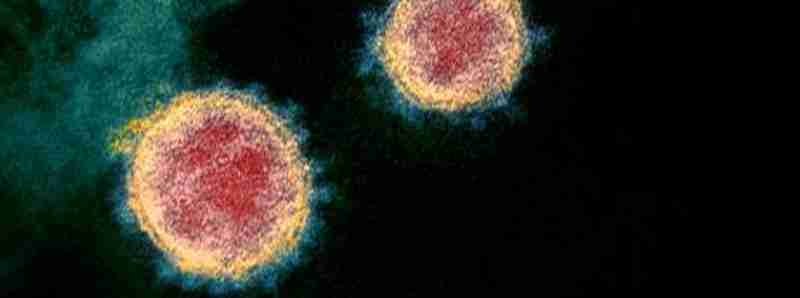Remdesivir è un antivirale sperimentale per il COVID-19