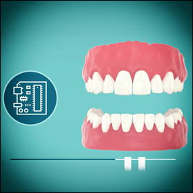 Sensori biologici da implementare ai denti per rilevare i primi segni di determinate malattie analizzando la saliva o il fluido crevicolare gengivale