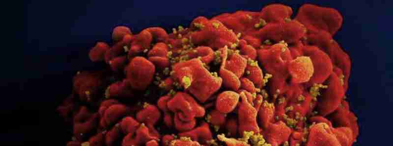 Finestra critica per la reinfezione da HIV dopo trapianto di cellule staminali
